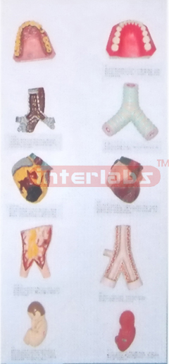 HANGING HUMAN COMPARISION MODEL BETWEEN HEALTH ORGANS AND SMOKING